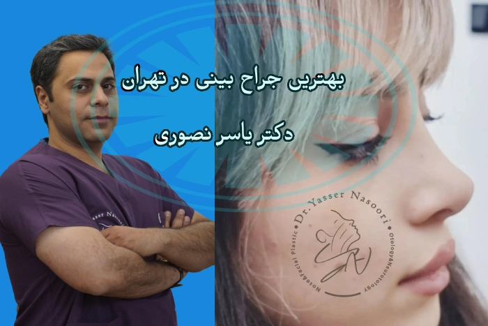 بهترین جراح بینی در تهران- دکتر یاسر نصوری