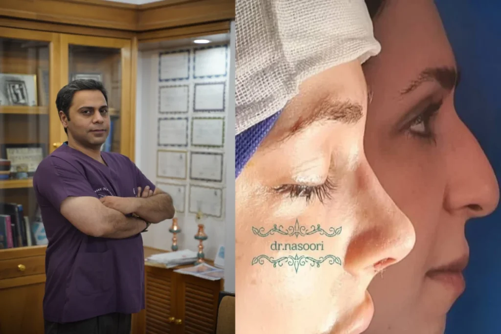 دکتر نصوری- بهترین جراح بینی استخوانی در تهران