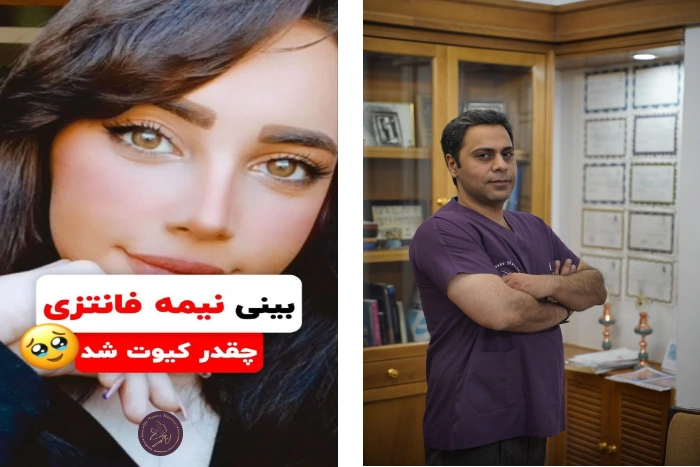 بهترین جراح بینی نیمه فانتزی در تهران- معرفی دکتر یاسر نصوری