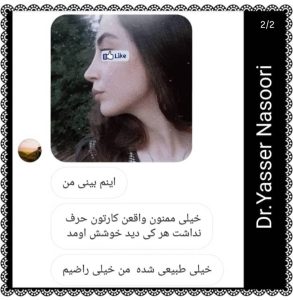 رضایت از عمل بینی