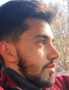 جرحی طبیعی بینی مردانه