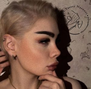 جراحی بینی طبیعی