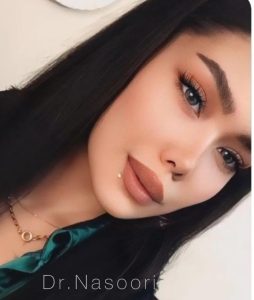 جراحی بینی نیمه فانتزی