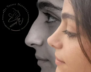 جراحی بینی نیمه فانتزی