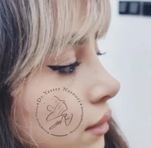 جراحی بینی نیمه فانتزی