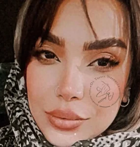 جراحی زیبایی بینی