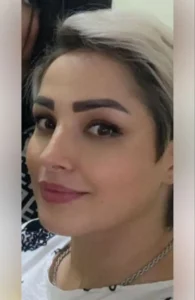 جراحی زیبایی بینی