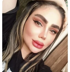 جراحی زیبایی بینی