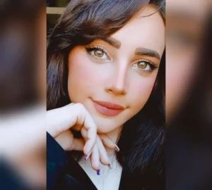 جراحی زیبایی بینی