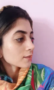 جراحی زیبایی بینی