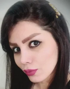 جراحی زیبایی بینی